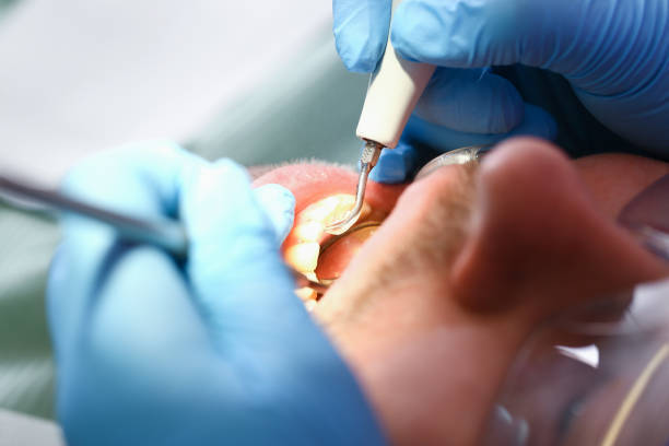 Best Emergency Dental Care for Broken or Chipped Teeth in Mertzon, TX