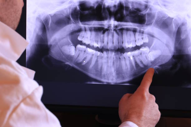 Best Same-Day Emergency Dental Services in Mertzon, TX