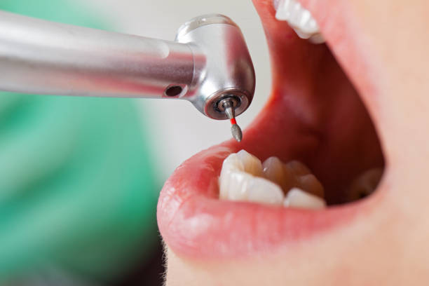 Best After-Hours Dental Trauma Care in Mertzon, TX
